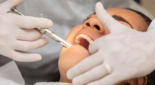 Implante dentário dura para sempre? Veja o que influencia a prótese