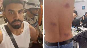 Professor acusa PMs de abordagem violenta e homofóbica no carnaval de Salvador: 'Imobilizado e envergonhado'