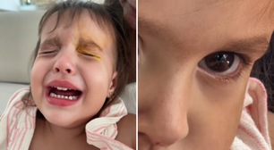 Menina de 2 anos tem corte na córnea durante brincadeira
