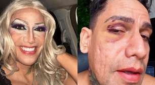 Homem denuncia homofobia ao ser agredido durante carnaval em Olinda (PE): 'Ele tentou me matar'