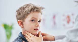 Parotidite viral: o que você precisa saber sobre a caxumba