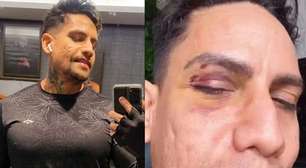 Arquiteto relata terror após ser agredido por se vestir como drag no Carnaval: "Saiu sangue"