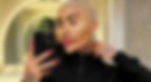 Influenciador famoso pelo tamanho dos lábios morre após suspeita de procedimento estético