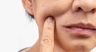 Nossa pele perde mais água no verão; você sabe o porquê?