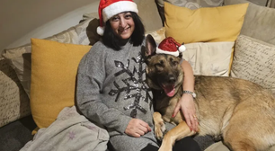 Mulher sofre amputação das mãos e pernas após sepse causa por lambida de pet