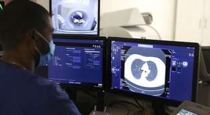 Quais as principais dúvidas dos pacientes que recebem um diagnóstico de câncer?