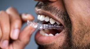 Alinhadores transparentes: tecnologia avança e muda a ortodontia