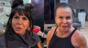 Gretchen surge sem prótese capilar e surpreende fãs