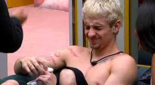 Acidentes na cozinha: o que fazer ao cortar o dedo em casa