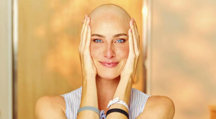 Atriz de Carinha de Anjo vive novo capítulo após fim da quimioterapia