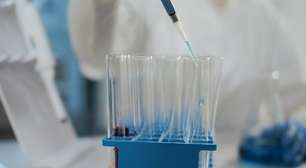 Uso de escovas técnicas em laboratórios integra protocolos de higienização