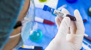 Mpox no Brasil: conheça as duas variantes e o risco real para a população