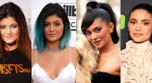 Kylie Jenner antes e depois do preenchimento labial: da 'boquinha' ao 'bocão', influenciadora transformou os lábios e ficou irreconhecível. Veja 28 fotos!
