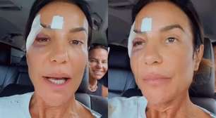 Ivete Sangalo recebe alta após desmaio e ferimentos no rosto