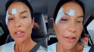 Ivete Sangalo comemora alta hospitalar após desmaio e brinca: 'Maquiagem diferente'