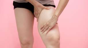 Lipedema afeta 11% das brasileiras; veja exercícios que aliviam