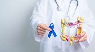 Silencioso e cada vez mais comum: câncer colorretal preocupa especialistas