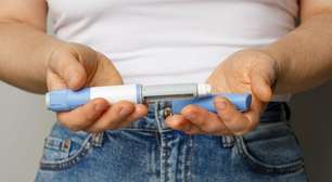 Ozempic e Mounjaro muda o rosto e exige 5 cuidados antes da harmonização