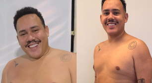 Ex-BBB Lucas Buda impressiona com antes e depois após perder 31 quilos