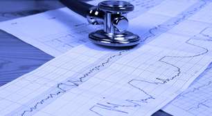 Fim da exclusividade do Procoralan promete tratamento cardíaco mais acessível