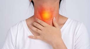 Esofagite severa: sintomas, tratamento e cuidados essenciais com o esôfago