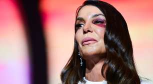 Ivete Sangalo faz primeiro show após acidente e explica: 'Fiz questão de vir assim'