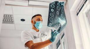 Aneurisma cerebral: sintomas, fatores de risco e quando ir ao hospital