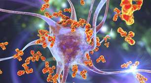 Mielite transversa: entenda a doença que afeta a medula espinhal