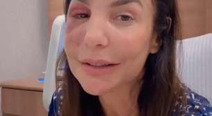 Como Ivete Sangalo está após cirurgia? Cantora explica quadro de saúde
