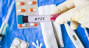 Mpox não é varíola humana: entenda as diferenças entre os vírus