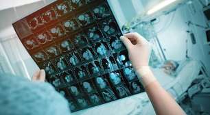 Aneurisma: veja sintomas, causas e tratamentos da condição que matou Adriana Araújo