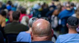 Esqueça os implantes caros: a ciência acaba de validar o "tesouro" chinês inesperado que promete reverter a calvície