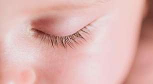 Caspa nos cílios? Descamação pode ser sinal de inflamação nos olhos