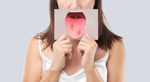 Tabaco sem fumaça aumenta risco de câncer de boca e preocupa especialistas