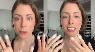 Fabiana Justus desabafa sobre transtorno que provoca compulsão de machucar a própria pele