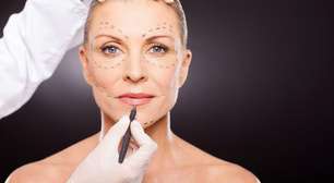 Lifting facial aos 40: Por que cada vez mais mulheres buscam a cirurgia