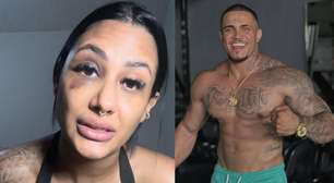 Influenciadora denuncia namorado fisiculturista por agressões: 'Pioravam a cada perdão'