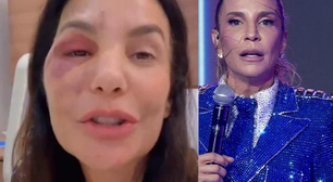 'Ela precisa se recuperar': após fratura no rosto e cirurgia recente, Ivete Sangalo é confirmada no 'BBB 26' e preocupa fãs
