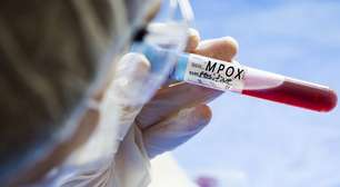 Mpox: O que você precisa saber deste vírus que voltou à tona