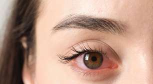 Moscas volantes na visão podem indicar problema ocular; entenda