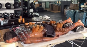Jogador do Juventus surpreende com imagem de terapia com ventosas