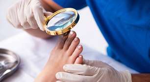 Fungos nas unhas dos pés: tratamentos caseiros que podem ajudar