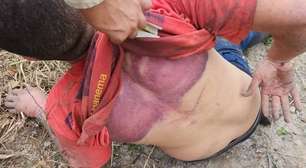 Motorista de aplicativo é sequestrado e torturado após ser confundido com informante da polícia