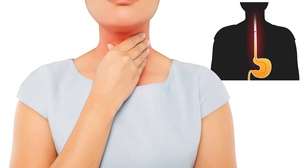 Refluxo gastroesofágico: sintomas, causas e tratamentos explicados