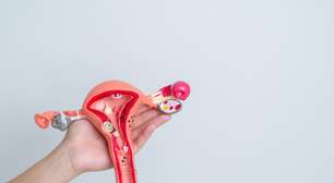 Endometriose: por que a doença ainda demora a ser diagnosticada no Brasil