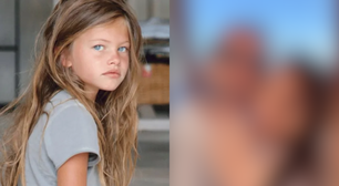 'Menina mais bonita do mundo' anuncia noivado; veja como ela está hoje com 24 anos