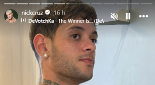 Ex-Estrela da Casa, Nick Cruz celebra mastectomia e diz viver recomeço