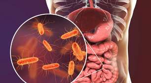 Bactérias que emagrecem: como o intestino pode influenciar na perda de peso