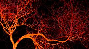 Perniose: como proteger sua pele do frio e evitar complicações