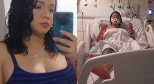 Jovem descobre síndrome rara após perder cerca de 95% da visão por reação alérgica a medicamento